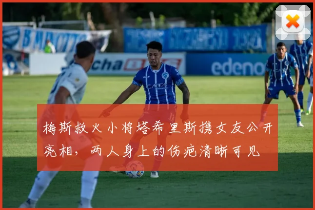 梅斯救火小将塔希里斯携女友公开亮相，两人身上的伤疤清晰可见